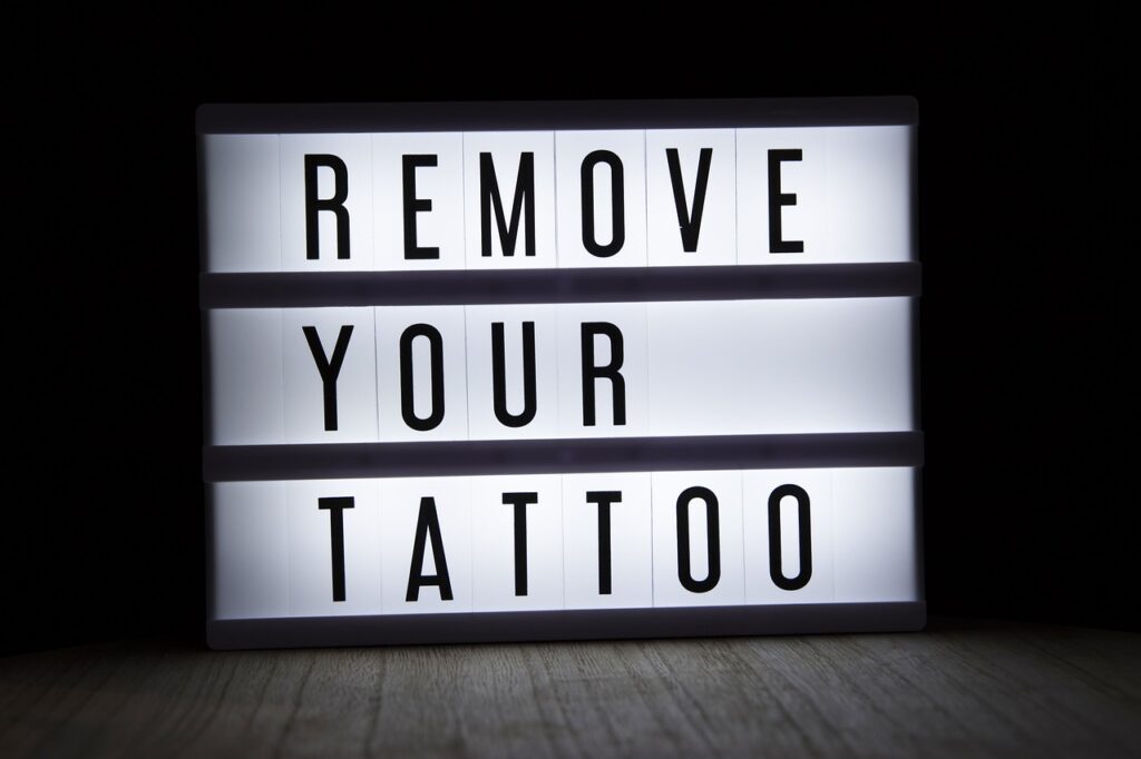 Tattoo Removal Journey